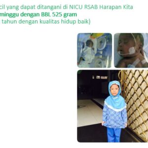 prematurterkecil