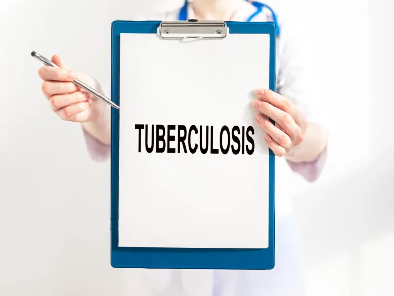Tuberkulosis